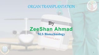 By
ZeeShan Ahmad
M.S Biotechnology
ORGAN TRANSPLANTATION
1
 