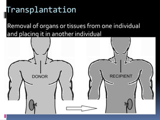 Transplantation
Removal of organs or tissues from one individual
and placing it in another individual
 Recipient
 