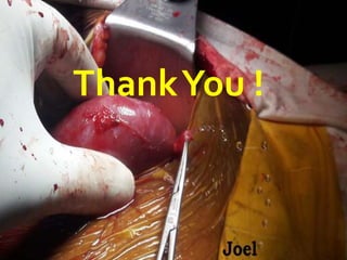 organ transplantation  nurses Joel Arudchelvam.pptx