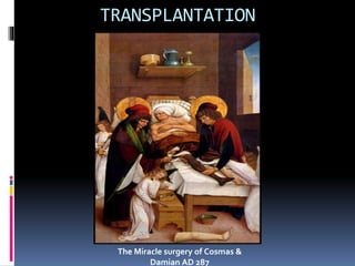 TRANSPLANTATION
The Miracle surgery of Cosmas &
Damian AD 287
 