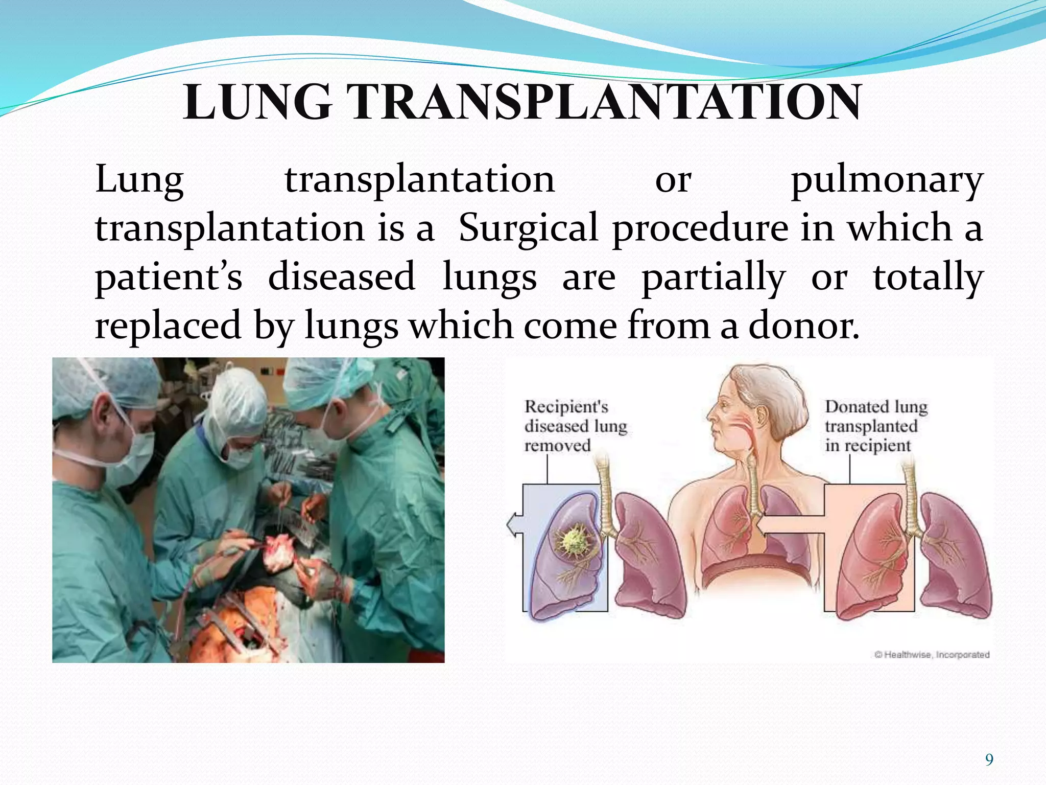 LUNG TRANSPLANTATION
Lung transplantation or pulmonary
transplantation is a Surgical procedure in which a
patient’s diseased lungs are partially or totally
replaced by lungs which come from a donor.
9
 