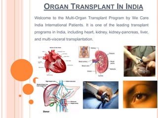 ORGAN TRANSPLANT IN INDIA
Welcome to the Multi-Organ Transplant Program by We Care
India International Patients. It is one of the leading transplant
programs in India, including heart, kidney, kidney-pancreas, liver,
and multi-visceral transplantation.

 