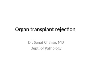 Comprehensive Overview of Organ Transplant Rejection and Immune ...