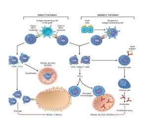 Comprehensive Overview of Organ Transplant Rejection and Immune ...