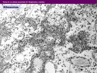 Tema 6: La célula eucariota II: Orgánulos y núcleo.
Ribosomas.
 