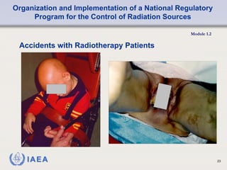 Organization and Implementation of a National Regulatory
Program for the Control of Radiation Sources
Module 1.2
23
Accidents with Radiotherapy Patients
 