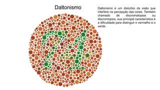 Daltonismo Daltonismo é um distúrbio da visão que
interfere na percepção das cores. Também
chamado de discromatopsia ou
discromopsia, sua principal característica é
a dificuldade para distinguir o vermelho e o
verde .
 