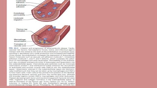 org Peripheral Arterial Disease 1.pptx t | PPTX