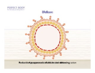 For the body you feel perfect in

                                          Before
                                          After




                     Reduction in appearance of cellulite skin surface
                             Appearance of cellulite on and slimming action
 