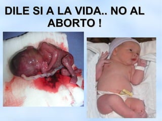 DILE SI A LA VIDA.. NO AL
        ABORTO !
 