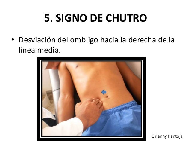 Calmar el dolor en la espalda por los ejercicios