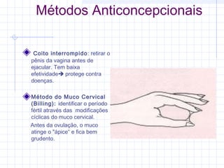 Métodos Anticoncepcionais
Coito interrompido: retirar o
pênis da vagina antes de
ejacular. Tem baixa
efetividade protege contra
doenças.
Método do Muco Cervical
(Billing): identificar o período
fértil através das modificações
cíclicas do muco cervical.
Antes da ovulação, o muco
atinge o "ápice“ e fica bem
grudento. 
 
