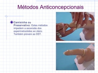 Métodos Anticoncepcionais
Camisinha ou
Preservativo: Estes métodos
impedem a ascensão dos
espermatozóides ao útero.
Também preveni as DST.
 