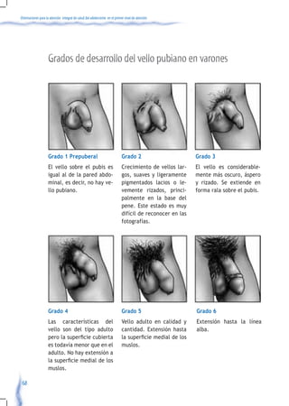 Orientaciones para la atención integral de salud del adolescente en el primer nivel de atención




                    Grados de desarrollo del vello pubiano en varones




                    Grado 1 Prepuberal                                     Grado 2                        Grado 3
                    El vello sobre el pubis es                             Crecimiento de vellos lar-     El vello es considerable-
                    igual al de la pared abdo-                             gos, suaves y ligeramente      mente más oscuro, áspero
                    minal, es decir, no hay ve-                            pigmentados lacios o le-       y rizado. Se extiende en
                    llo pubiano.                                           vemente rizados, princi-       forma rala sobre el pubis.
                                                                           palmente en la base del
                                                                           pene. Este estado es muy
                                                                           difícil de reconocer en las
                                                                           fotografías.




                    Grado 4                                                Grado 5                        Grado 6
                    Las características del                                Vello adulto en calidad y      Extensión hasta la línea
                    vello son del tipo adulto                              cantidad. Extensión hasta      alba.
                    pero	la	superficie	cubierta	                           la	superficie	medial	de	los	
                    es todavía menor que en el                             muslos.
                    adulto. No hay extensión a
                    la	superficie	medial	de	los	
                    muslos.

 68
 