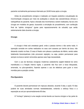 Orientacoes cirurgia ortognatica blog