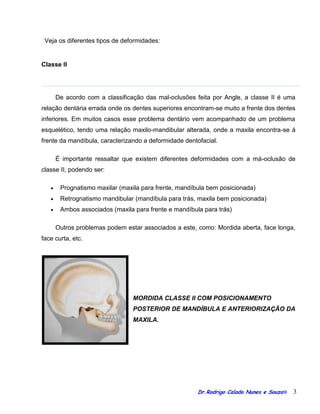 Orientacoes cirurgia ortognatica blog