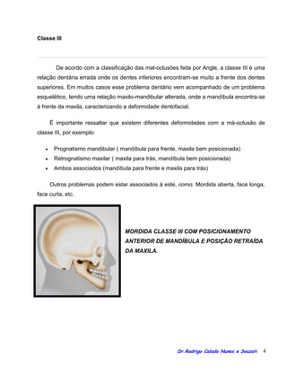 Orientacoes cirurgia ortognatica blog