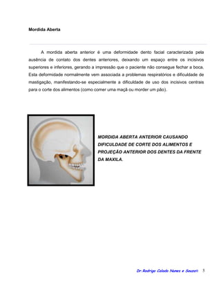 Orientacoes cirurgia ortognatica blog