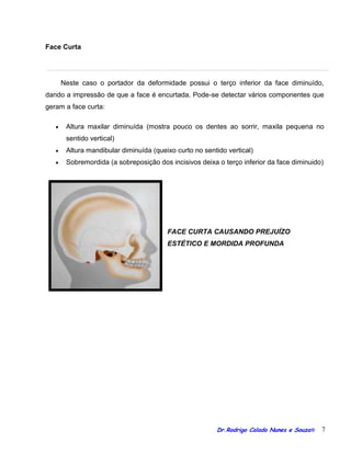 Orientacoes cirurgia ortognatica blog