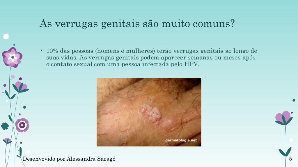 Hpv Quanto Tempo Demora Para Desaparecer
