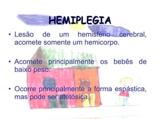 HEMIPLEGIA Lesão de um hemisfério cerebral, acomete somente um hemicorpo. Acomete principalmente os bebês de baixo peso. Ocorre principalmente a forma espástica, mas pode ser atetósica. 