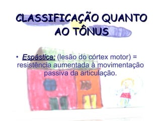 CLASSIFICAÇÃO QUANTO AO TÔNUS Espástica:  (lesão do córtex motor) =  resistência aumentada à movimentação passiva da articulação. 