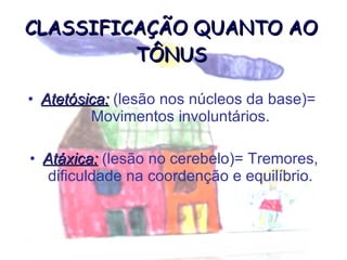 CLASSIFICAÇÃO QUANTO AO TÔNUS Atetósica:  (lesão nos núcleos da base)=  Movimentos involuntários. Atáxica:  (lesão no cerebelo)= Tremores, dificuldade na coordenção e equilíbrio. 