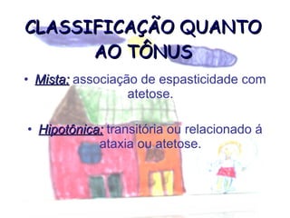 CLASSIFICAÇÃO QUANTO AO TÔNUS Mista:  associação de espasticidade com atetose. Hipotônica:  transitória ou relacionado á ataxia ou atetose. 