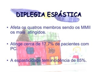 DIPLEGIA ESPÁSTICA Afeta os quatros membros sendo os MMII  os mais  atingidos. Atinge cerca de 17,7% de pacientes com PC. A espasticidade tem incidência de 85%. 