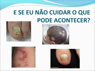 E SE EU NÃO CUIDAR O QUE 
PODE ACONTECER? 
 