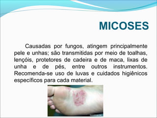 MICOSES 
Causadas por fungos, atingem principalmente 
pele e unhas; são transmitidas por meio de toalhas, 
lençóis, protetores de cadeira e de maca, lixas de 
unha e de pés, entre outros instrumentos. 
Recomenda-se uso de luvas e cuidados higiênicos 
específicos para cada material. 
 