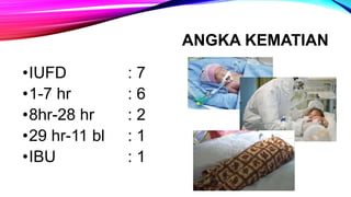 ANGKA KEMATIAN
•IUFD : 7
•1-7 hr : 6
•8hr-28 hr : 2
•29 hr-11 bl : 1
•IBU : 1
 