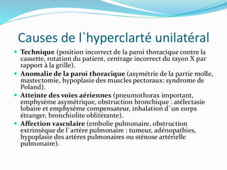 Causes de l`hyperclarté unilatéral
 Technique (position incorrect de la paroi thoracique contre la
cassette, rotation du patient, centrage incorrect du rayon X par
rapport à la grille).
 Anomalie de la paroi thoracique (asymétrie de la partie molle,
mastectomie, hypoplasie des muscles pectoraux: syndrome de
Poland).
 Atteinte des voies aériennes (pneumothorax important,
emphysème asymétrique, obstruction bronchique : atélectasie
lobaire et emphysème compensateur, inhalation d`un corps
étranger, bronchiolite oblitérante).
 Affection vasculaire (embolie pulmonaire, obstruction
extrinsèque de l`artère pulmonaire : tumeur, adénopathies,
hypoplasie des artères pulmonaires ou sténose artérielle
pulmonaire).
 