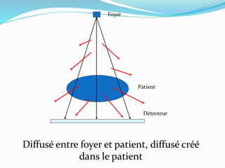 Foyer
Patient
Détecteur
Diffusé entre foyer et patient, diffusé créé
dans le patient
 