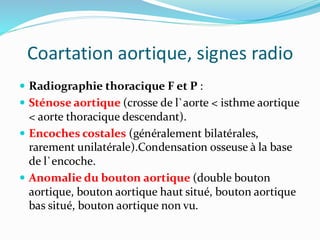 Coartation aortique, signes radio
 Radiographie thoracique F et P :
 Sténose aortique (crosse de l`aorte < isthme aortique
< aorte thoracique descendant).
 Encoches costales (généralement bilatérales,
rarement unilatérale).Condensation osseuse à la base
de l`encoche.
 Anomalie du bouton aortique (double bouton
aortique, bouton aortique haut situé, bouton aortique
bas situé, bouton aortique non vu.
 