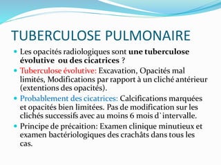 TUBERCULOSE PULMONAIRE
 Les opacités radiologiques sont une tuberculose
évolutive ou des cicatrices ?
 Tuberculose évolutive: Excavation, Opacités mal
limités, Modifications par rapport à un cliché antérieur
(extentions des opacités).
 Probablement des cicatrices: Calcifications marquées
et opacités bien limitées. Pas de modification sur les
clichés successifs avec au moins 6 mois d`intervalle.
 Principe de précaition: Examen clinique minutieux et
examen bactériologiques des crachâts dans tous les
cas.
 
