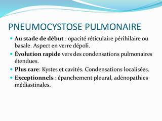 PNEUMOCYSTOSE PULMONAIRE
 Au stade de début : opacité réticulaire périhilaire ou
basale. Aspect en verre dépoli.
 Évolution rapide vers des condensations pulmonaires
étendues.
 Plus rare: Kystes et cavités. Condensations localisées.
 Exceptionnels : épanchement pleural, adénopathies
médiastinales.
 