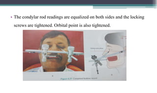 Condylar Rods ORIENTATION JAW RELATION.pptx