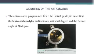 Inclination Guide Str ORIENTATION JAW RELATION.pptx