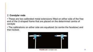 Condylar Rods ORIENTATION JAW RELATION.pptx
