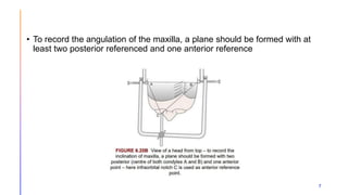 Maxillary Plane Rotation ORIENTATION JAW RELATION.pptx