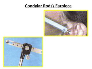 31 Jul 06
Condylar Rods Earpiece
 