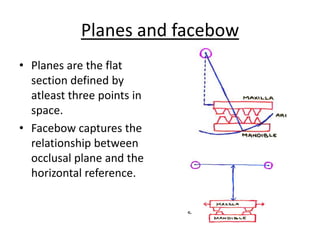 Planes and facebow
• Planes are the flat
section defined by
atleast three points in
space.
• Facebow captures the
relationship between
occlusal plane and the
horizontal reference.
 