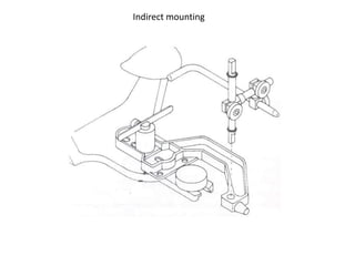 Indirect mounting
 