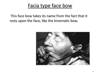 44
Facia type face bow
This face bow takes its name from the fact that it
rests upon the face, like the kinematic bow.
 