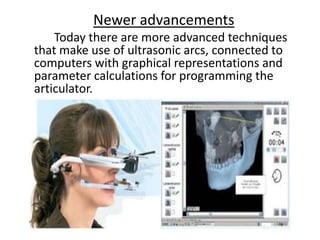 Newer advancements
Today there are more advanced techniques
that make use of ultrasonic arcs, connected to
computers with graphical representations and
parameter calculations for programming the
articulator.
 