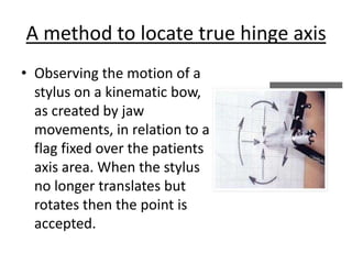 A method to locate true hinge axis
• Observing the motion of a
stylus on a kinematic bow,
as created by jaw
movements, in relation to a
flag fixed over the patients
axis area. When the stylus
no longer translates but
rotates then the point is
accepted.
 