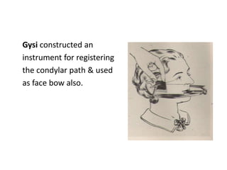 Facebow
Stansberry (1928) was dubious about
the value of facebow and adjustable
articulators. He thought that since an ope...