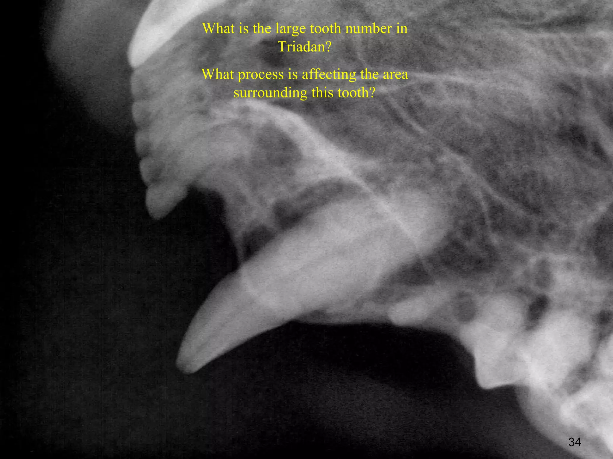 What is the large tooth number in
            Triadan?
What process is affecting the area
    surrounding this tooth?




                                     34
 