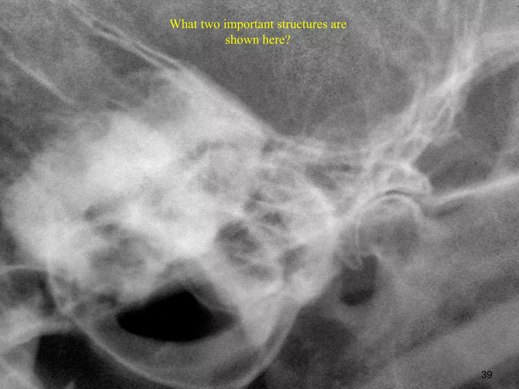 What two important structures are
          shown here?




                                    39
 